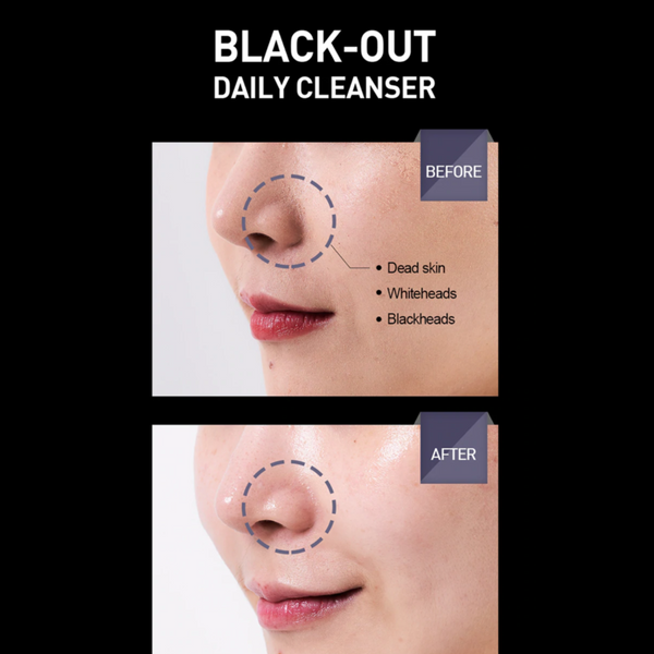 DR. WONDER Black-Out Wonder Cleanser Charcoal Cleanser & Mask Made in Korea